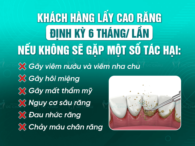 Khách hàng lấy cao răng định kỳ 6 tháng/ lần nếu không sẽ gặp một số tác hại