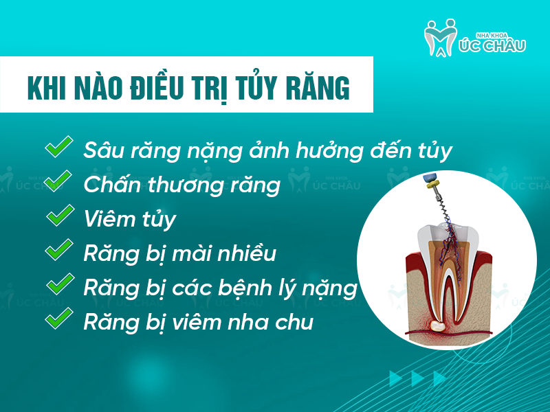 Khi nào điều trị tủy răng