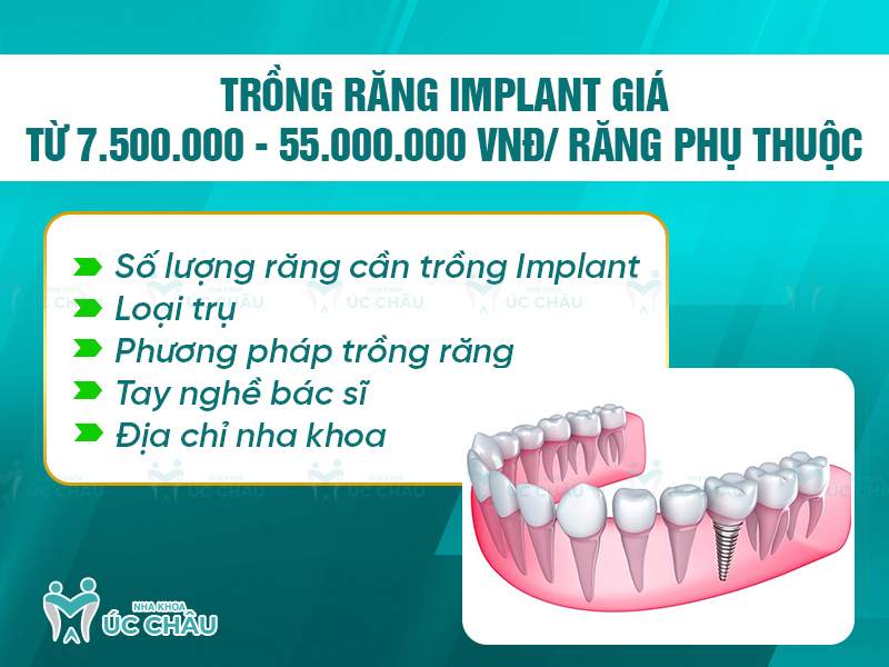 Trồng răng implant giá từ 7.500.000 - 55.000.000 VNĐ/ răng phụ thuộc