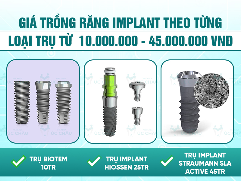 Giá trồng răng implant theo từng loại trụ từ 10.000.000 - 45.000.000 VNĐ