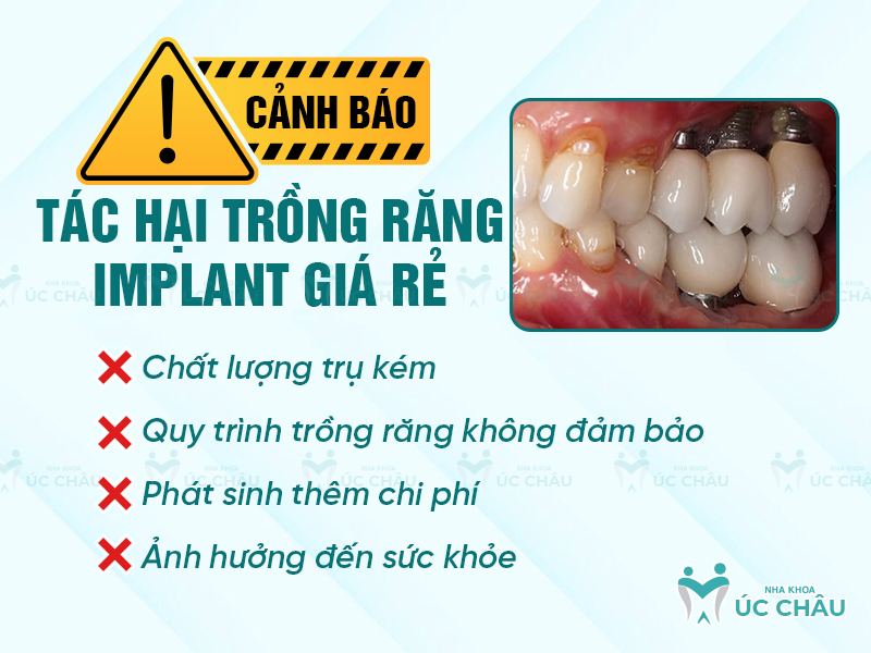 Tác hại trồng răng implant giá rẻ