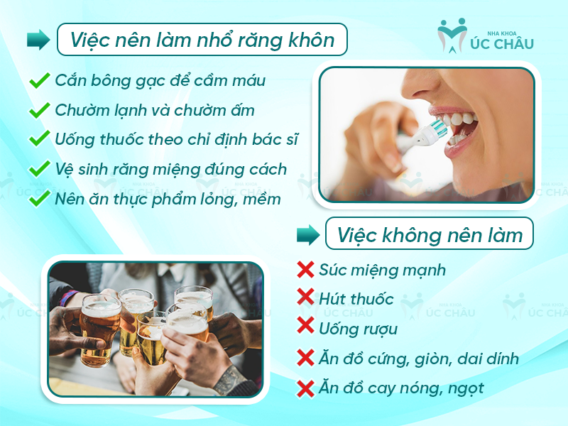 Việc nên và không nên khi nhổ răng khôn