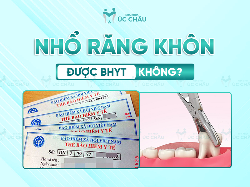 Nhổ răng khôn được Bảo hiểm Y tế không?