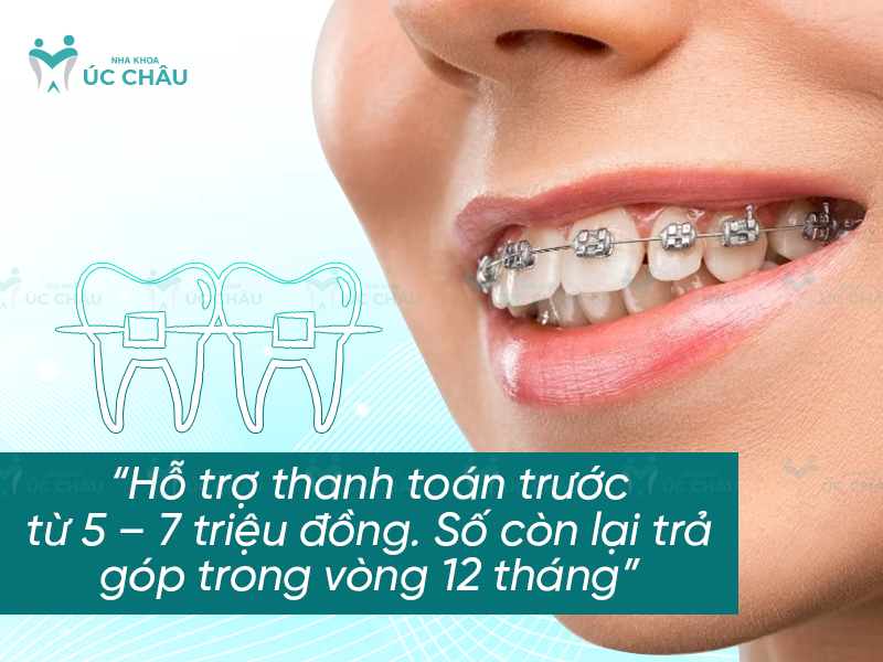 Hỗ trợ thanh toán trước từ 5 – 7 triệu đồng. Số còn lại trả góp trong vòng 12 tháng