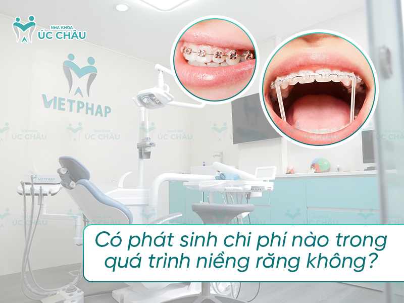 Có phát sinh chi phí nào trong quá trình niềng răng không? 