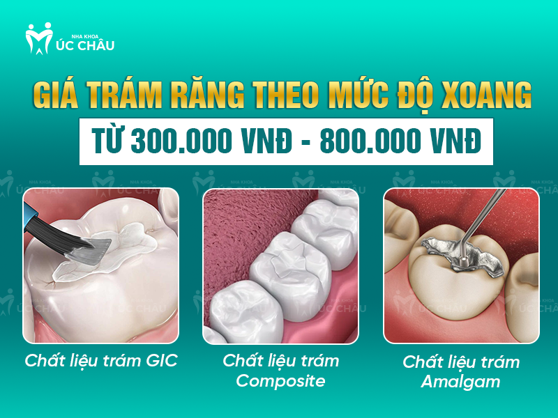 Giá trám răng theo mức độ xoang từ 300.000 VNĐ - 800.000 VNĐ