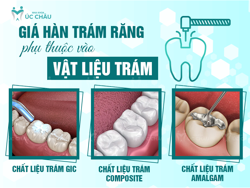 Giá hàn trám răng phụ thuộc vào vật liệu trám