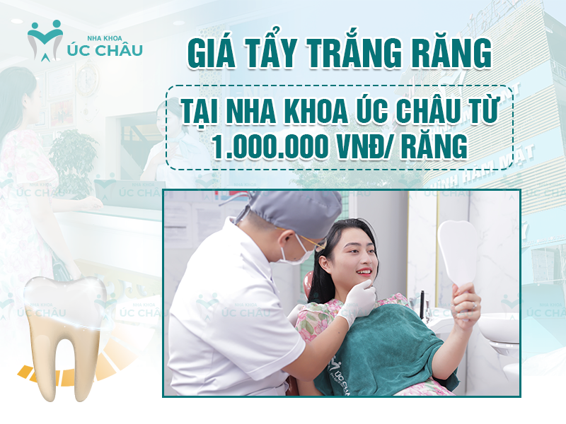 Giá tẩy trắng răng tại Nha khoa Úc Châu từ 1.000.000 VNĐ/ răng