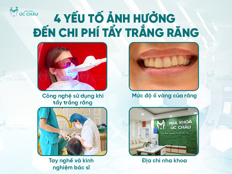 4 yếu tố ảnh hưởng đến chi phí tẩy trắng răng