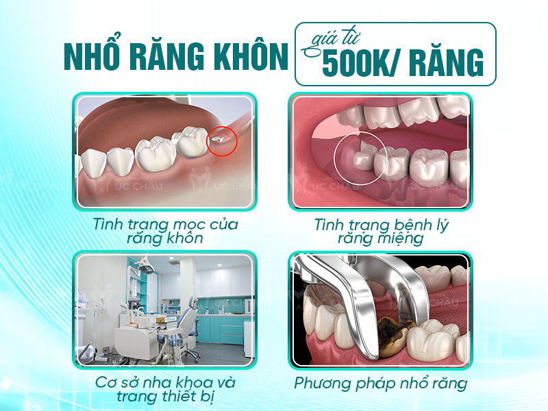 Nhổ răng khôn giá từ 500.000 VNĐ/ răng phụ thuộc vào