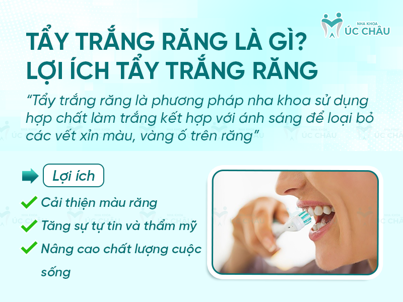 Tẩy trắng răng là gì? Lợi ích tẩy trắng răng