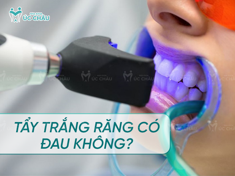 Tẩy trắng răng có đau không? 