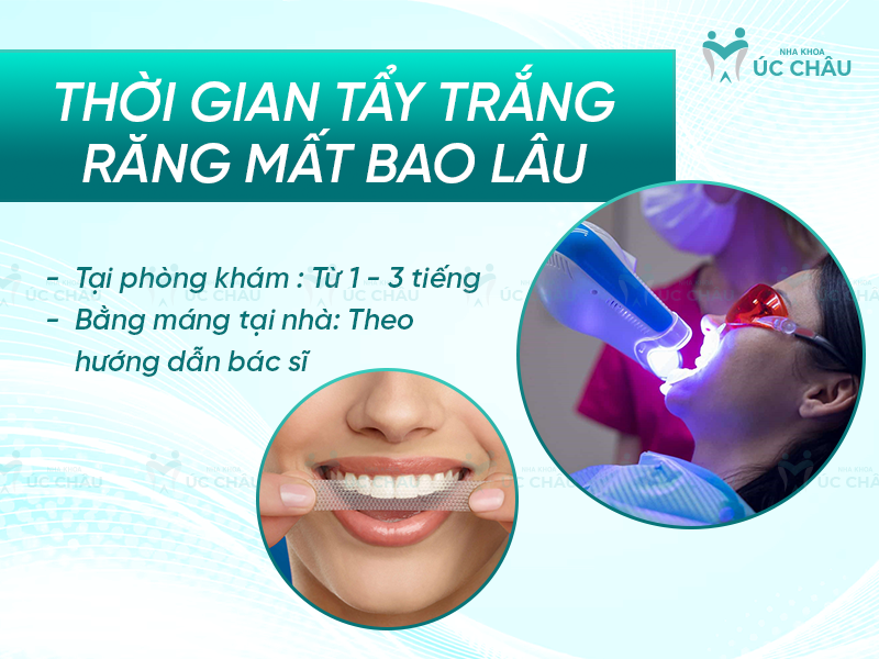 Thời gian tẩy trắng răng mất bao lâu