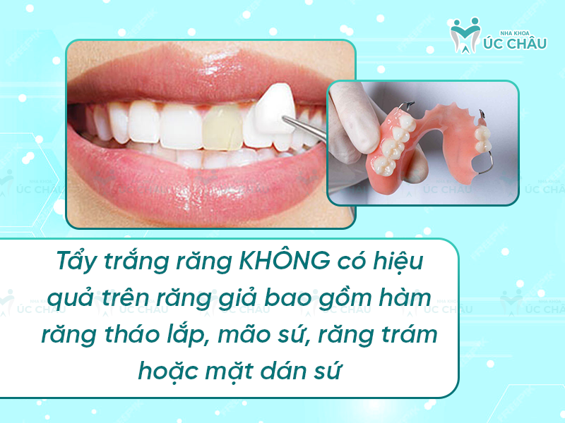 Tẩy trắng răng KHÔNG có hiệu quả trên răng giả bao gồm hàm răng tháo lắp, mão sứ, răng trám hoặc mặt dán sứ