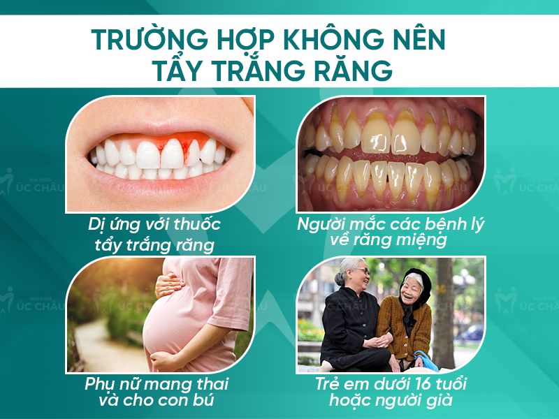 Trường hợp không nên tẩy trắng răng