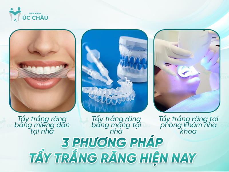 3 phương pháp tẩy trắng răng hiện nay