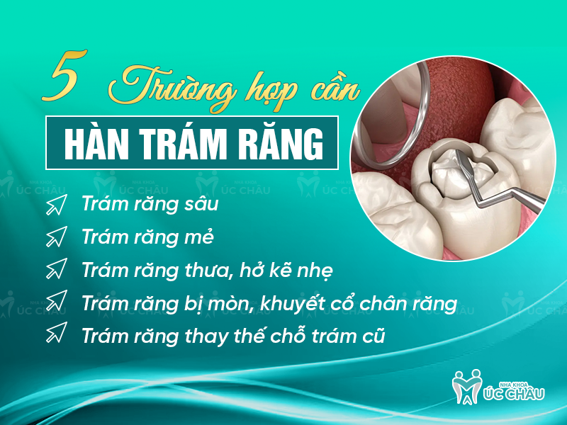 5 Trường hợp cần hàn trám răng