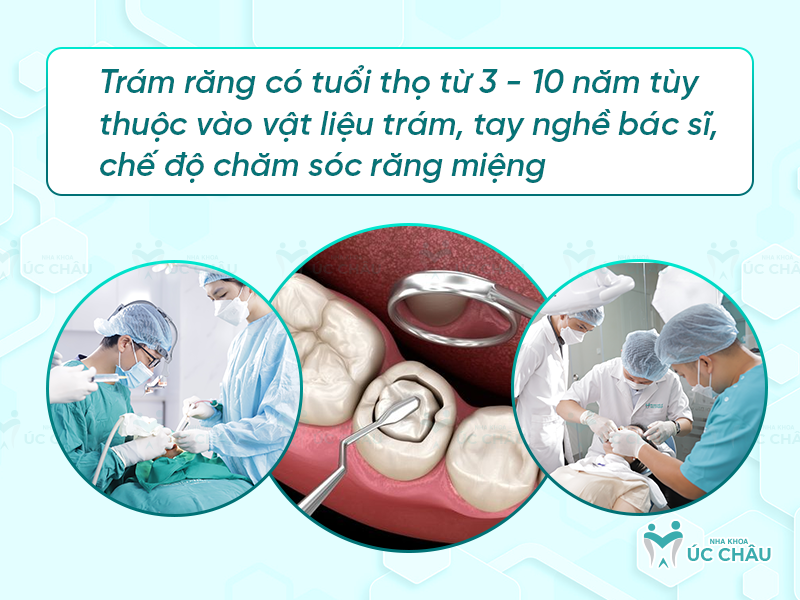 Trám răng có tuổi thọ từ 3 - 10 năm tùy thuộc vào vật liệu trám, tay nghề bác sĩ, chế độ chăm sóc răng miệng